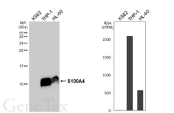 Anti-S100A4 antibody [HL6259] used in Western Blot (WB). GTX648351