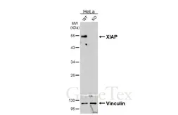 Anti-XIAP antibody [HL6316] used in Western Blot (WB). GTX648426