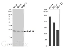 Anti-RAB1B antibody [HL6331] used in Western Blot (WB). GTX648441