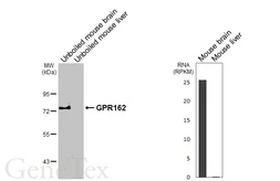 Anti-GPR162 antibody [HL6359] used in Western Blot (WB). GTX648798