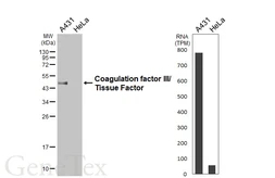 Anti-Coagulation factor III/Tissue Factor antibody [HL6378] used in Western Blot (WB). GTX648817