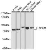 Anti-GPSM2 antibody used in Western Blot (WB). GTX64884