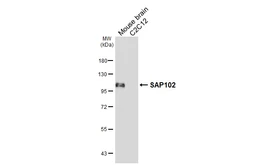 Anti-SAP102 antibody [HL6440] used in Western Blot (WB). GTX648888