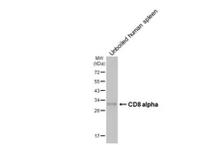 Anti-CD8 alpha antibody [HL6447] used in Western Blot (WB). GTX648895