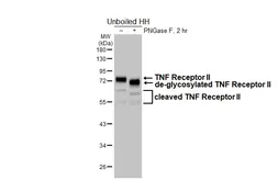 Anti-TNF Receptor II antibody [HL6463] used in Western Blot (WB). GTX648911