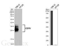 Anti-CD70 antibody [HL6469] used in Western Blot (WB). GTX648917