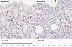 Anti-S100A8 antibody [HL6492] used in IHC (Paraffin sections) (IHC-P). GTX648948