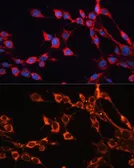 Anti-SLC25A24 antibody used in Immunocytochemistry/ Immunofluorescence (ICC/IF). GTX64897