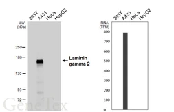 Anti-Laminin gamma 2 antibody [HL6518] used in Western Blot (WB). GTX648974