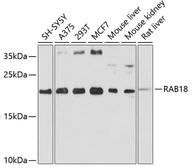 Anti-RAB18 antibody used in Western Blot (WB). GTX64901