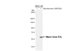 Anti-Mpox virus G1L antibody [HL6543] used in Western Blot (WB). GTX649013