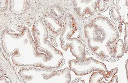 Anti-AMACR antibody [HL6548] used in IHC (Paraffin sections) (IHC-P). GTX649018