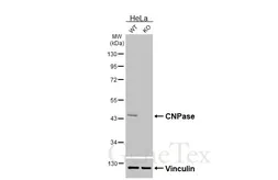 Anti-CNPase antibody [HL6556] used in Western Blot (WB). GTX649026