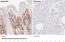 Anti-MZB1 antibody [HL6563] used in IHC (Paraffin sections) (IHC-P). GTX649033