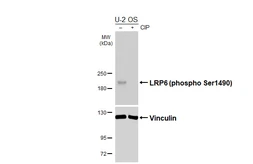 Anti-LRP6 (phospho Ser1490) antibody [HL6592] used in Western Blot (WB). GTX649062