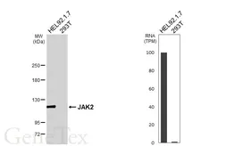 Anti-JAK2 antibody [HL6611] used in Western Blot (WB). GTX649311