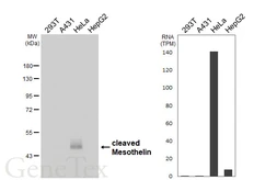 Anti-Mesothelin antibody [HL6631] used in Western Blot (WB). GTX649331