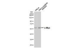 Anti-c-Myc antibody [HL6638] used in Western Blot (WB). GTX649347