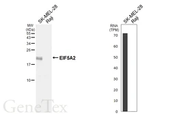 Anti-EIF5A2 antibody [HL6662] used in Western Blot (WB). GTX649371