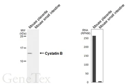 Anti-Cystatin B antibody [HL6675] used in Western Blot (WB). GTX649384