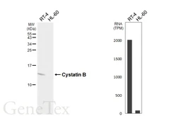 Anti-Cystatin B antibody [HL6676] used in Western Blot (WB). GTX649385
