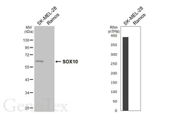 Anti-SOX10 antibody [HL6760] used in Western Blot (WB). GTX649491
