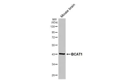 Anti-BCAT1 antibody [HL6780] used in Western Blot (WB). GTX649511