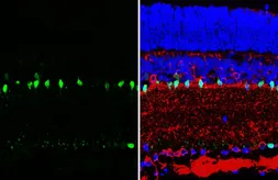 Anti-Parvalbumin antibody [HL6815] used in IHC (Paraffin sections) (IHC-P). GTX649629
