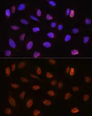 Anti-CSTF2T antibody used in Immunocytochemistry/ Immunofluorescence (ICC/IF). GTX64989