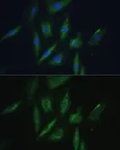 Anti-SRPR beta antibody used in Immunocytochemistry/ Immunofluorescence (ICC/IF). GTX64995
