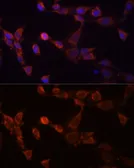 Anti-PSMD14 antibody used in Immunocytochemistry/ Immunofluorescence (ICC/IF). GTX64996