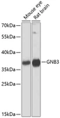 Anti-GNB3 antibody used in Western Blot (WB). GTX65528