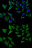 Anti-ATOX1 antibody used in Immunocytochemistry/ Immunofluorescence (ICC/IF). GTX65531