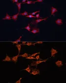 Anti-GSTM3 antibody used in Immunocytochemistry/ Immunofluorescence (ICC/IF). GTX65535