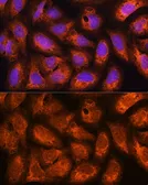 Anti-ACAP2 antibody used in Immunocytochemistry/ Immunofluorescence (ICC/IF). GTX65554