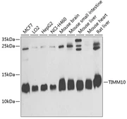Anti-TIMM10 antibody used in Western Blot (WB). GTX65592