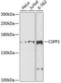 Anti-CSPP1 antibody used in Western Blot (WB). GTX65610