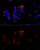 Anti-ABCG8 antibody used in Immunocytochemistry/ Immunofluorescence (ICC/IF). GTX65624