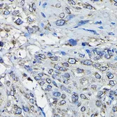 Anti-RanGAP1 antibody used in IHC (Paraffin sections) (IHC-P). GTX65813