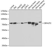 Anti-MTGR1 antibody used in Western Blot (WB). GTX65822