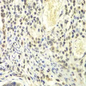 Anti-PSMA4 antibody used in IHC (Paraffin sections) (IHC-P). GTX65846