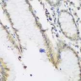 Anti-NAT13 antibody used in IHC (Paraffin sections) (IHC-P). GTX65849