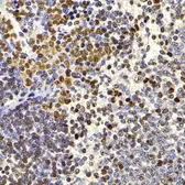 Anti-HIRIP3 antibody used in IHC (Paraffin sections) (IHC-P). GTX65853