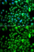 Anti-CSRP2BP antibody used in Immunocytochemistry/ Immunofluorescence (ICC/IF). GTX65856