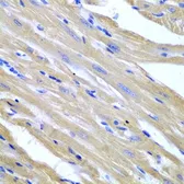 Anti-HSPB2 antibody used in IHC (Paraffin sections) (IHC-P). GTX65869
