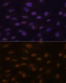 Anti-MyoD1 antibody used in Immunocytochemistry/ Immunofluorescence (ICC/IF). GTX65875