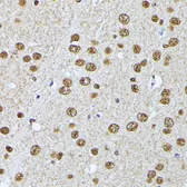 Anti-hnRNP L antibody used in IHC (Paraffin sections) (IHC-P). GTX65879