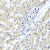 Anti-ITPKB antibody used in IHC (Paraffin sections) (IHC-P). GTX65942