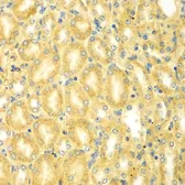 Anti-Myomegalin antibody used in IHC (Paraffin sections) (IHC-P). GTX65962