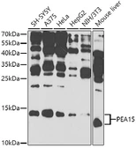 Anti-PEA15 antibody used in Western Blot (WB). GTX65994